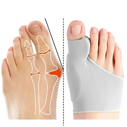 Toe Alignment Corrector