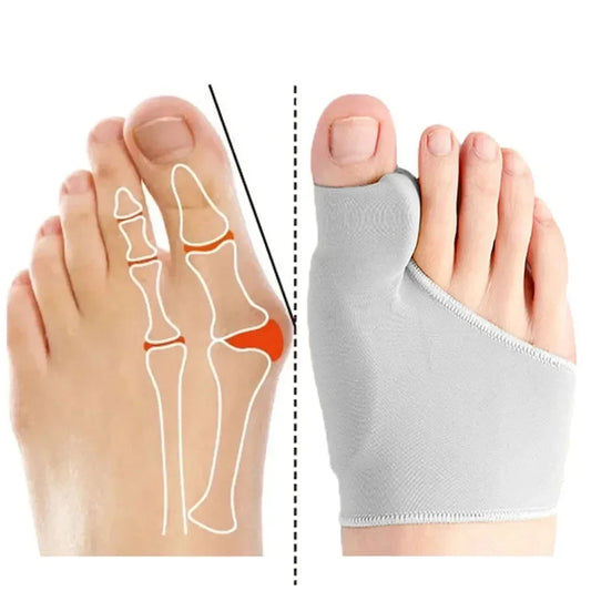 Toe Alignment Corrector