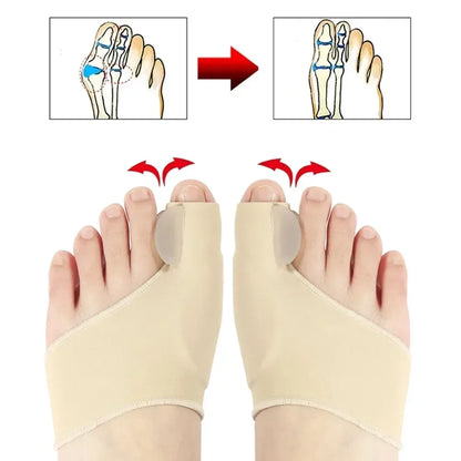 Toe Alignment Corrector